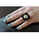 Anello 3